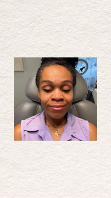 Instagram post by @euro_look_medical_spa