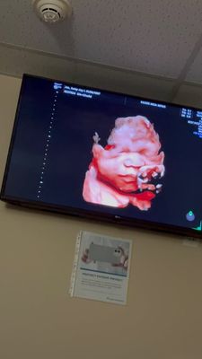 Instagram post by @jureyjao