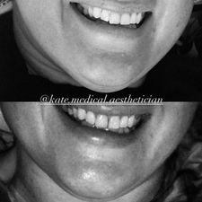 Instagram post by @kate.medical.aesthetician