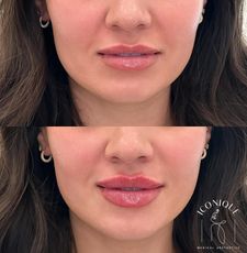 Instagram post by @marissa_beauty_rn