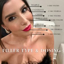 Instagram post by @marissa_beauty_rn