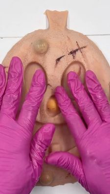 Instagram post by @mochipimplepopperasmr