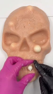 Instagram post by @mochipimplepopperasmr