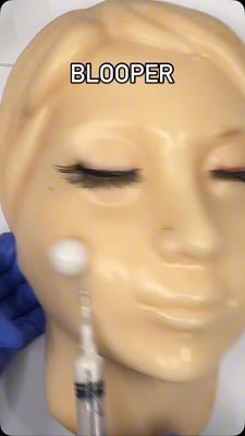 Instagram post by @mochipimplepopperasmr