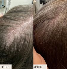 Instagram post by @modernskinfrisco