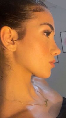 Instagram post by @okland.facial.plastic.surgery