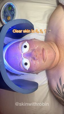 Instagram post by @skinwithrobin